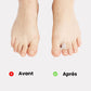 Fabric strap looped around the toes and forefoot to straighten a claw toe