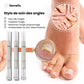 Toenail fungus serum in a slim applicator pen for brushing onto the nail