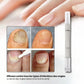 Toenail fungus serum in a slim applicator pen for brushing onto the nail