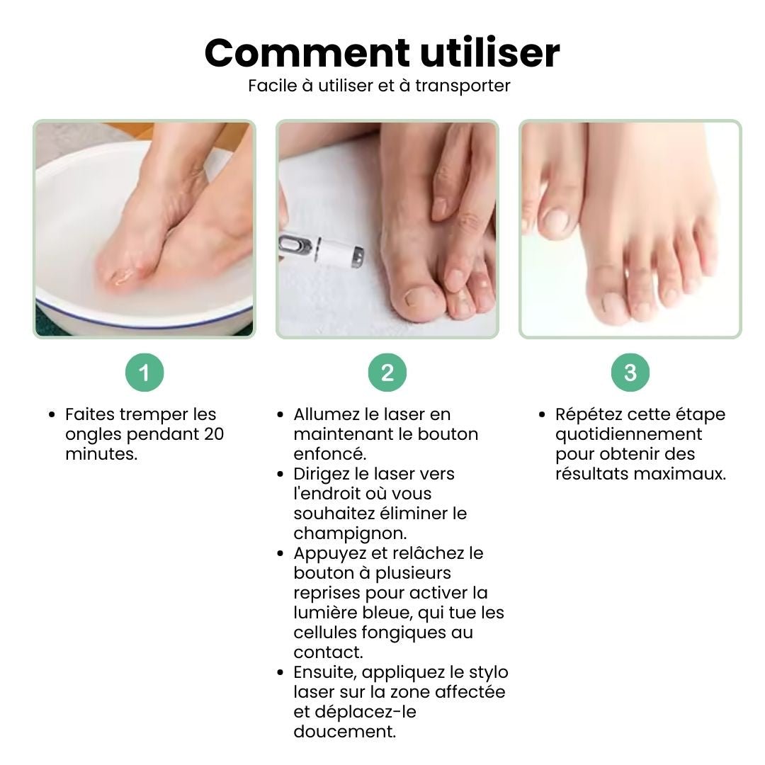 Handheld laser pen held over the toenail to treat nail fungus at home