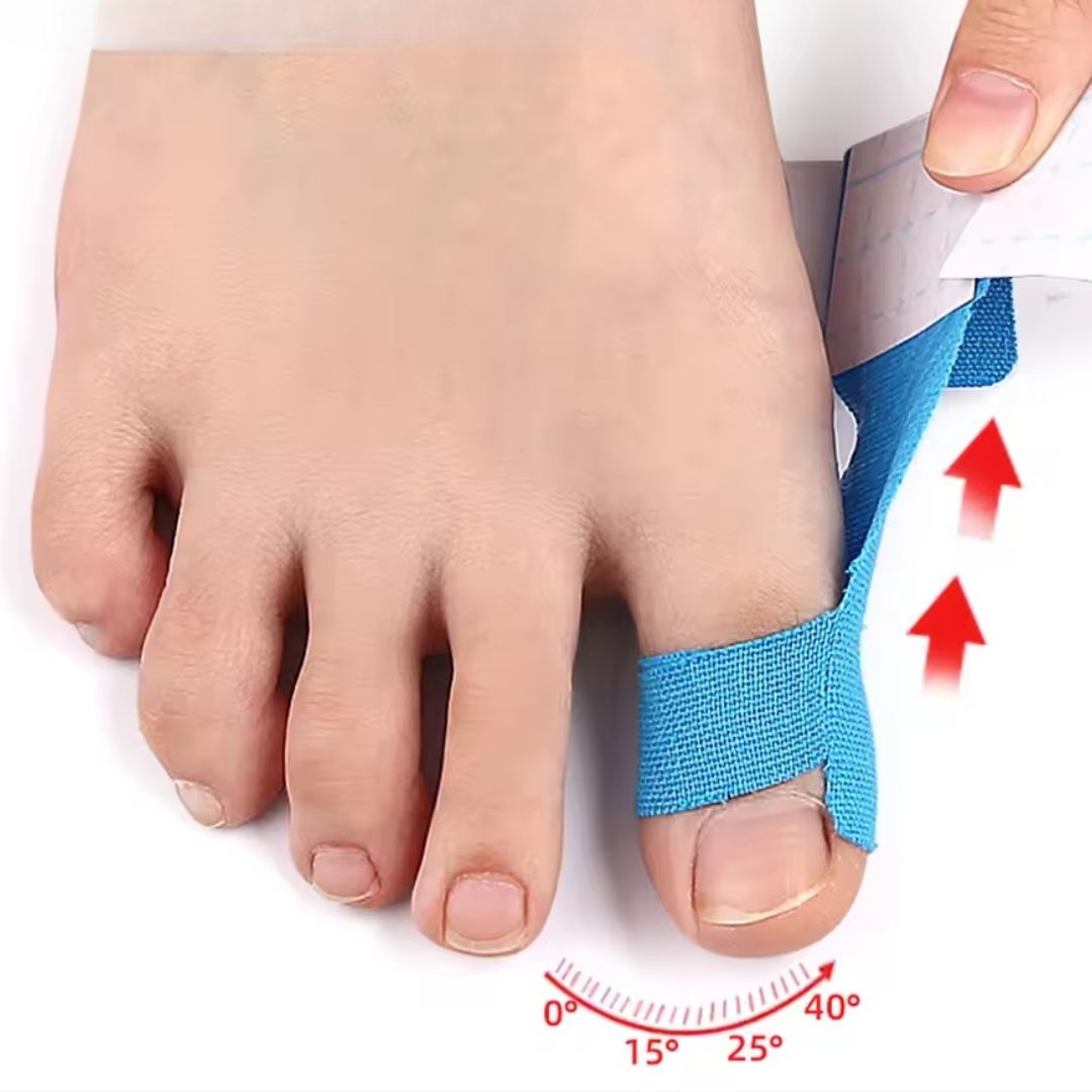 Sky blue elastic bunion tape strips applied along the side of the big toe