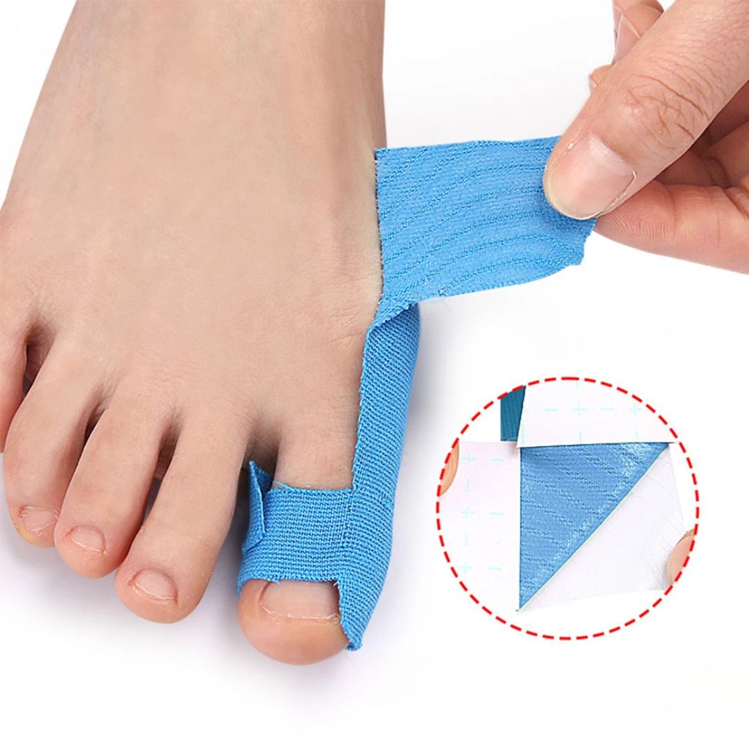 Sky blue elastic bunion tape strips applied along the side of the big toe